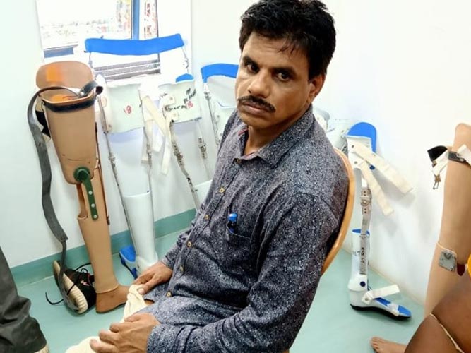 Fitment of Free artificial limbs and calipers